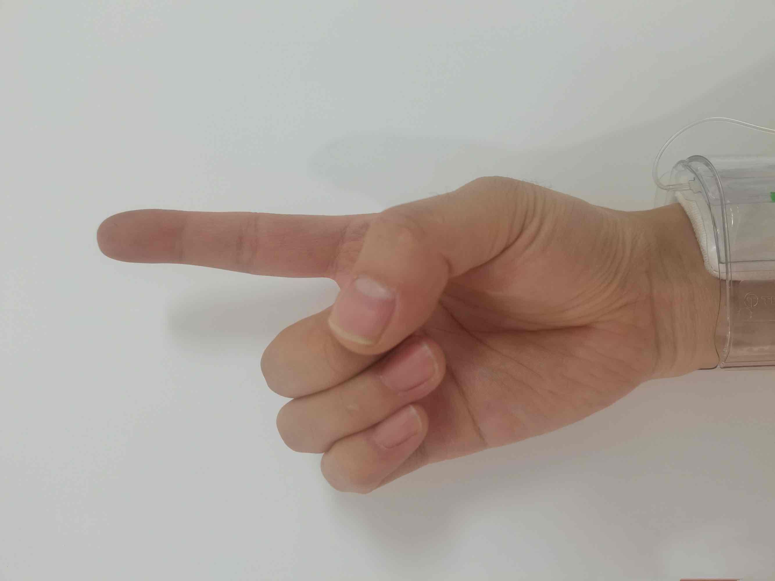 小小手指操，解决介入术后患者大问题