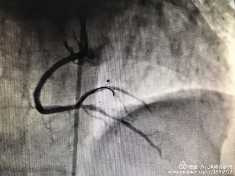 脑心同治 我们在路上 脑心同治 我们在路上