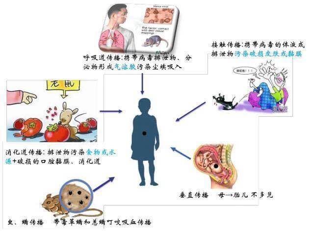 【健康科普】恶心 呕吐 腹痛——也要警惕出血热! 【健康科普】恶心 呕吐 腹痛——也要警惕出血热!