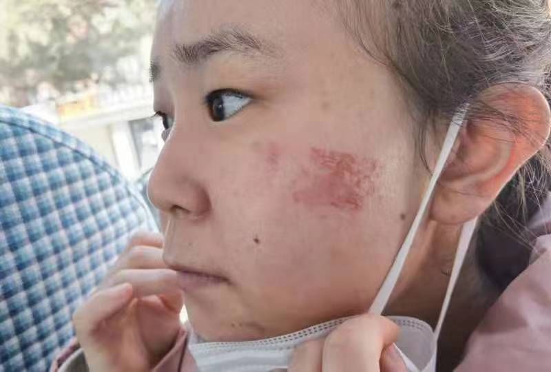 在阳光下——西安市第九医院驰援吉林抗疫纪实（四） 核酸采样八组