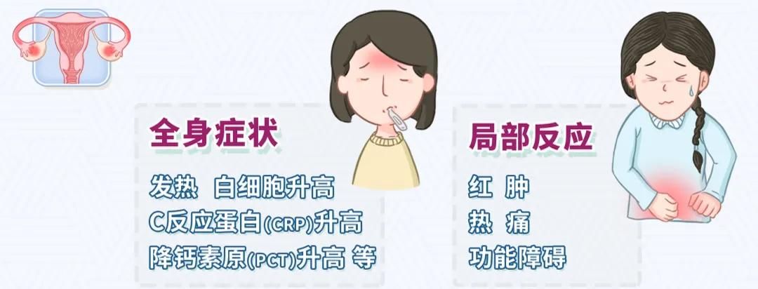 盆腔炎那些你不知道的事