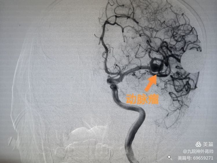 【急救直击】铭记历史不忘初心——神经外科西迁老师救治小记 【急救直击】铭记历史不忘初心——神经外科西迁老师救治小记