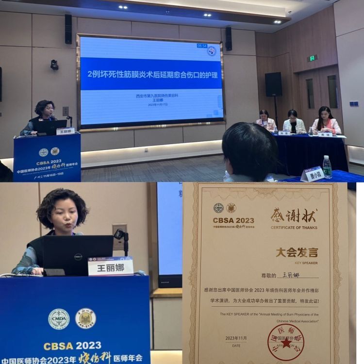 西安市第九医院自体微粒皮肉芽创面种植手术新方法在中国医师协会2023年烧伤科医师年会上报告交流引起同道关注 西安市第九医院自体微粒皮肉芽创面种植手术新方法在中国医师协会2023年烧伤科医师年会上报告交流引起同道关注