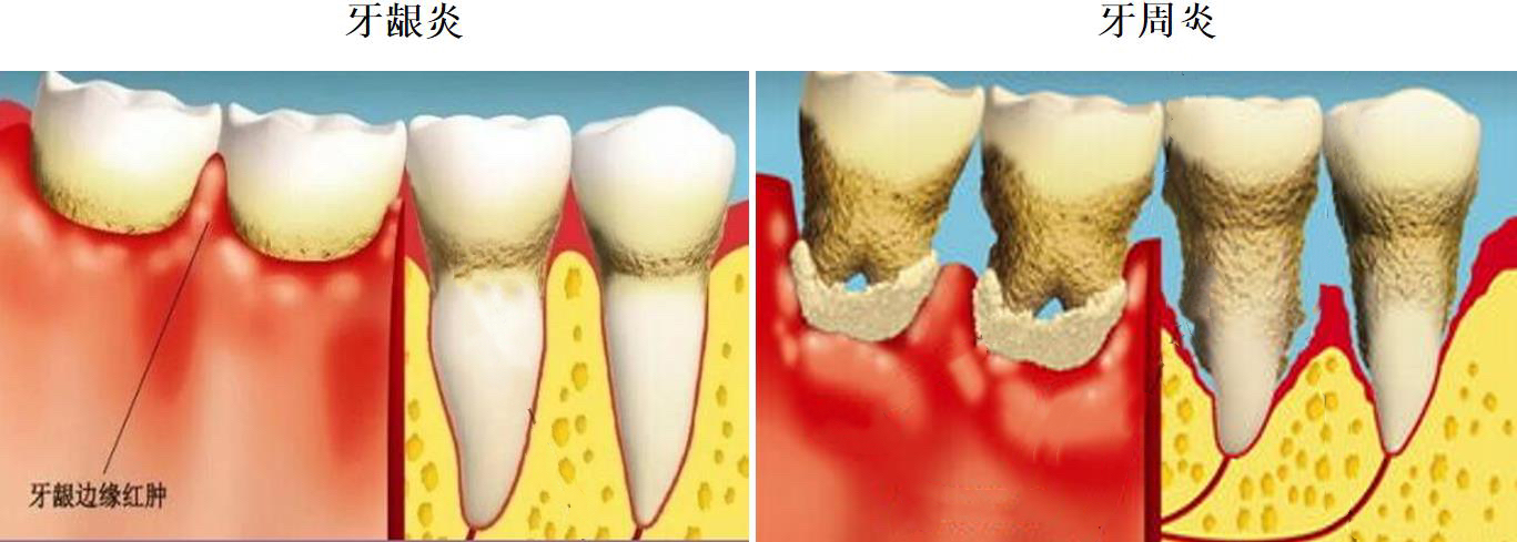 牙科国庆节宣传 牙科国庆节宣传
