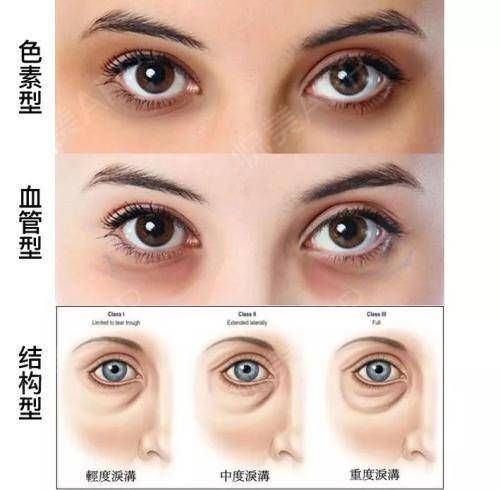 心血管病院——你，睡得好吗？