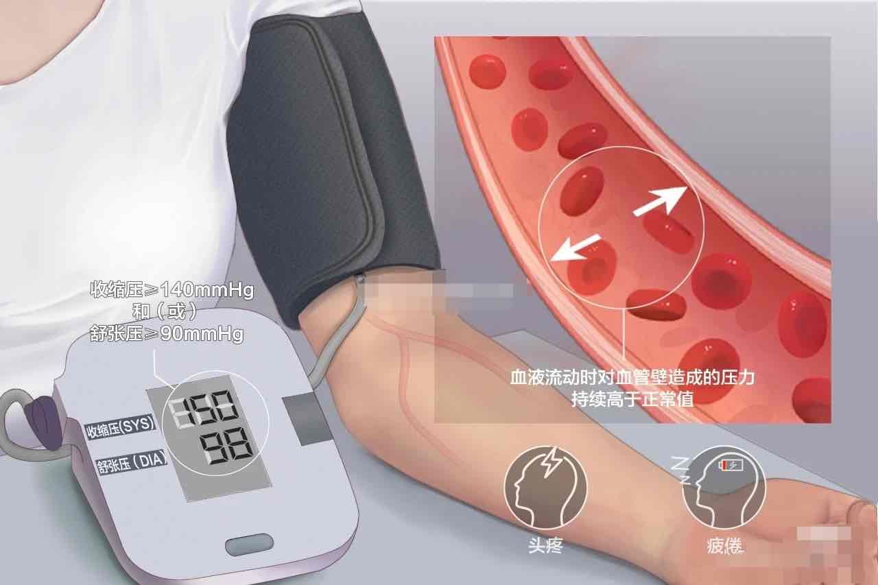 让我们一起揭开高血压真相！！！