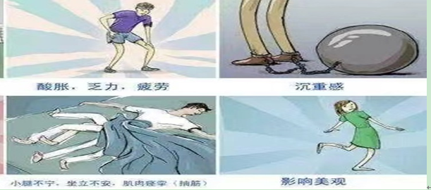 【健康科普】“蚯蚓腿”是怎样形成的? 【健康科普】“蚯蚓腿”是怎样形成的?