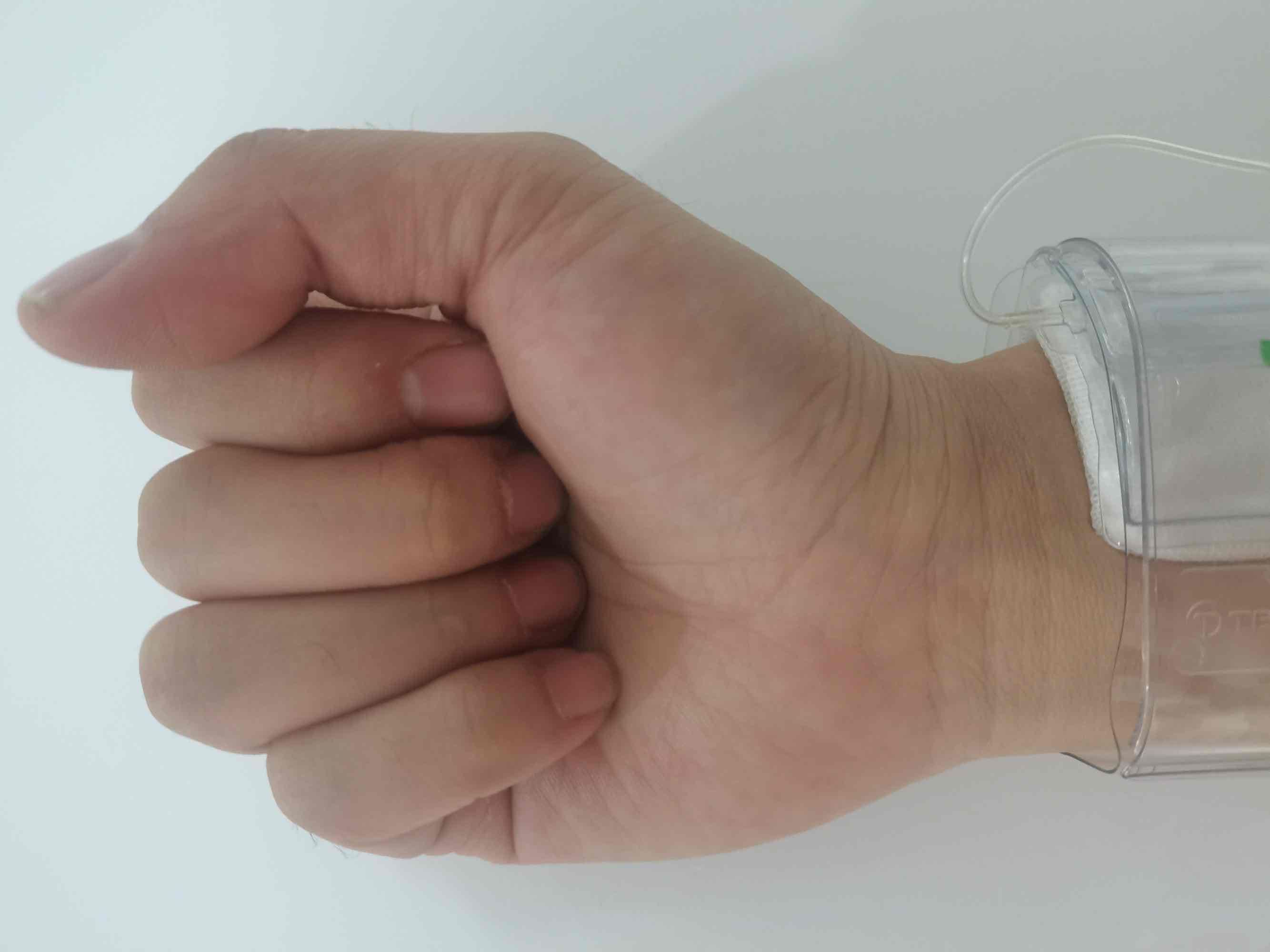 小小手指操，解决介入术后患者大问题