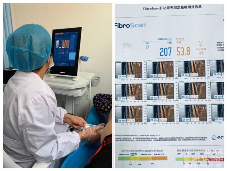 全国爱肝日义诊活动—呵护健康,“肝”心为你 全国爱肝日义诊活动—呵护健康,“肝”心为你