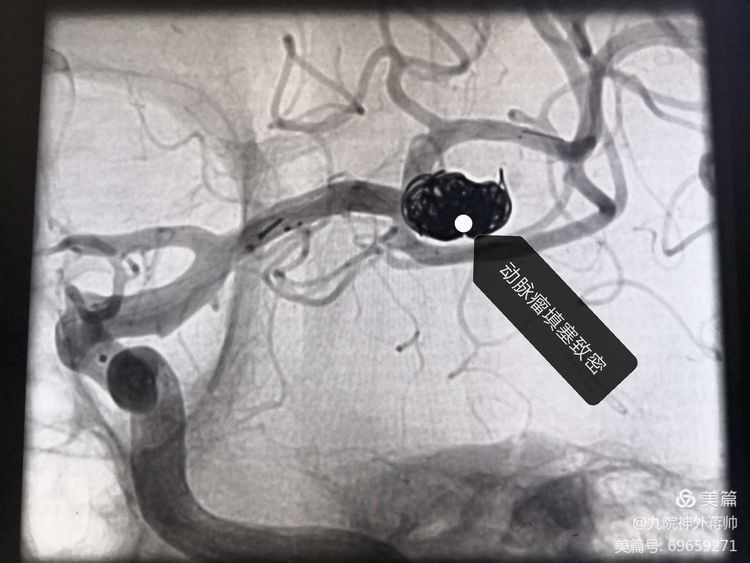 【急救直击】铭记历史不忘初心——神经外科西迁老师救治小记 【急救直击】铭记历史不忘初心——神经外科西迁老师救治小记
