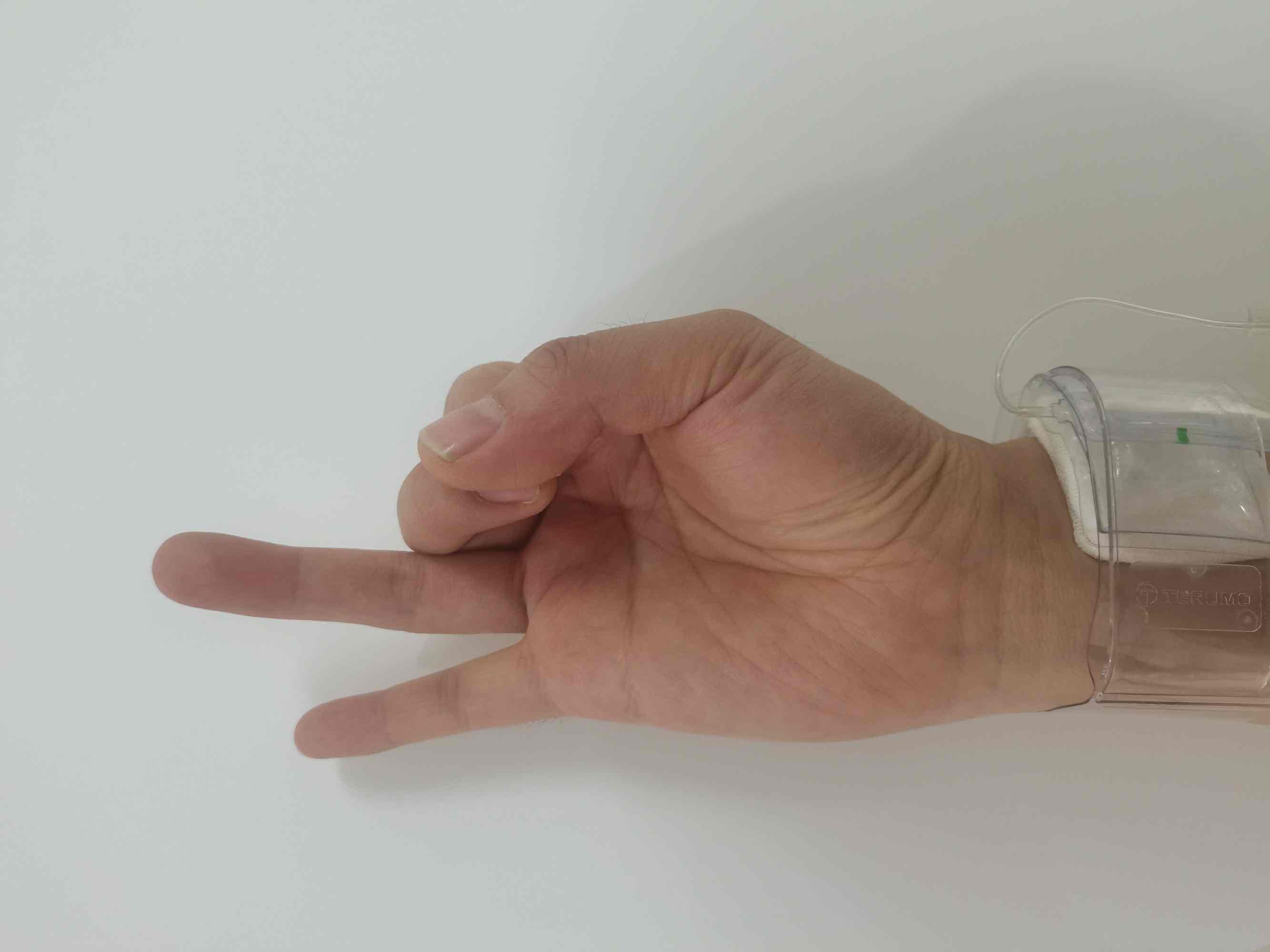 小小手指操，解决介入术后患者大问题