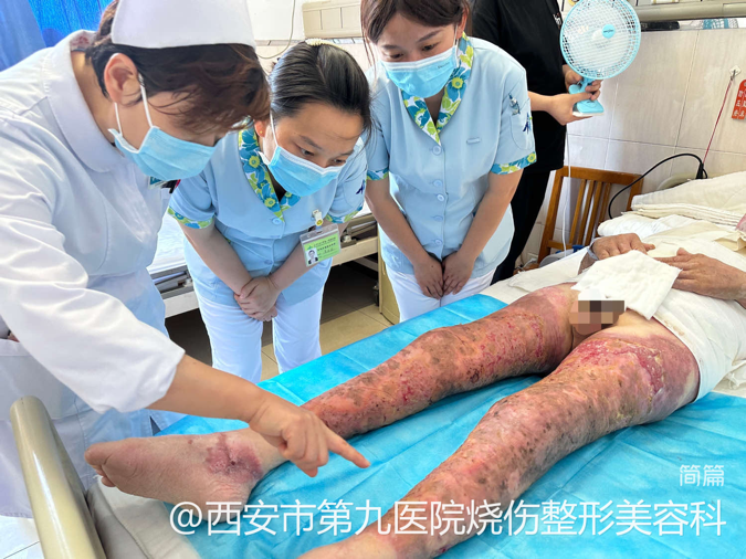 西安市第九医院烧伤整形美容科圆满完成西安EWMA国际伤口治疗师学校临床实习基地临床带教工作