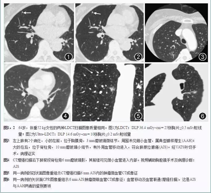 西安市第九医院最新引进的超高端CT已正式投入使用