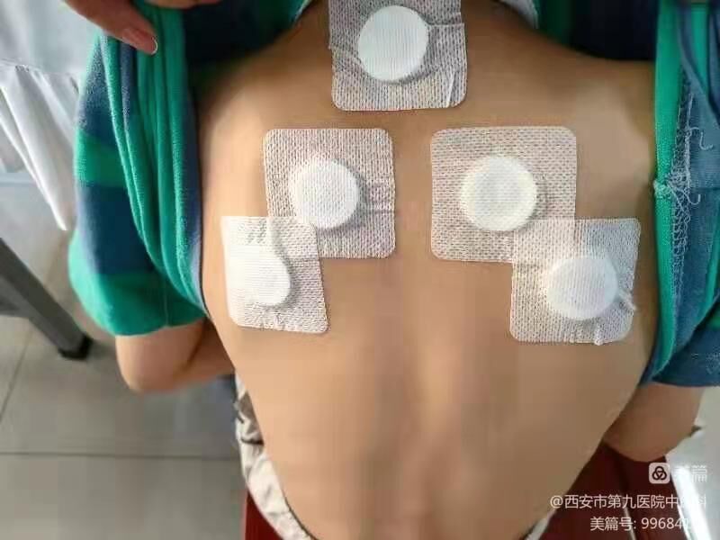 西安市第九医院中医科三伏贴预约活动开始喽！