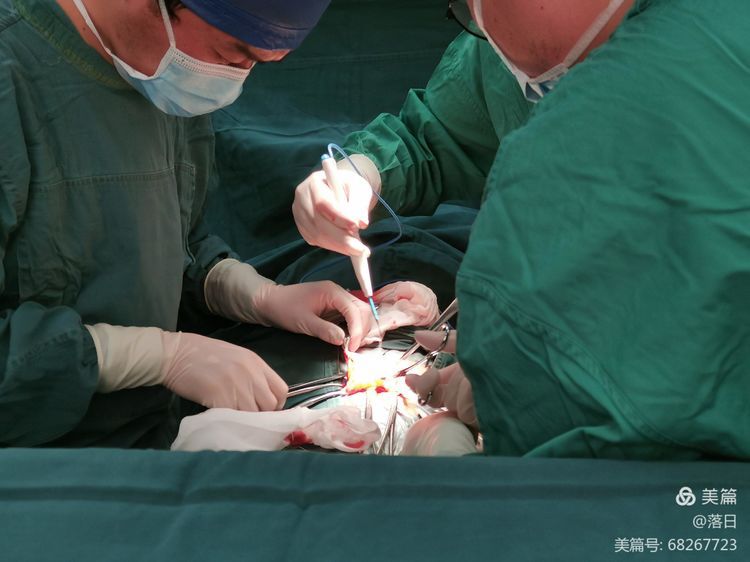 泌尿外科进行一腹股沟巨大疝修补术