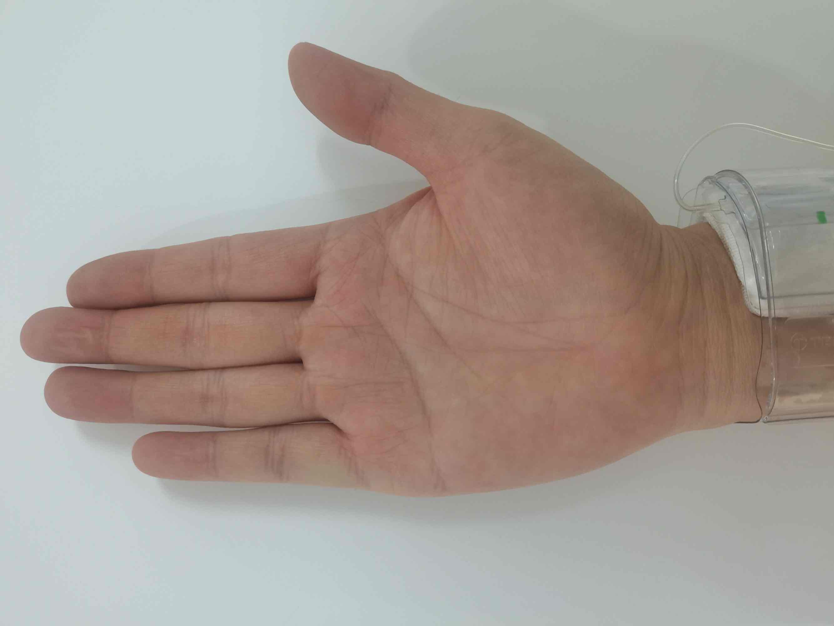 小小手指操，解决介入术后患者大问题