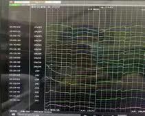 【科室动态】开通堵塞生命的河道