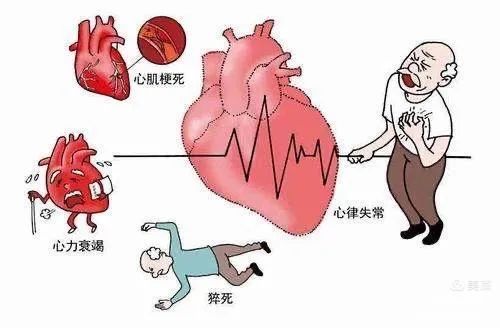【健康科普】冠心病最怕吃什么食物 【健康科普】冠心病最怕吃什么食物