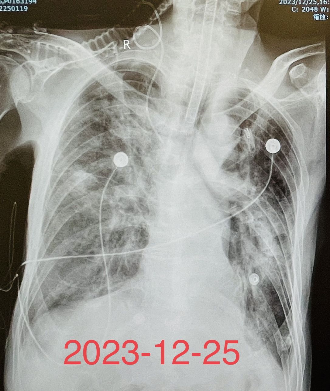 呼吸与危重症医学科,用心守护每一个生命! 呼吸与危重症医学科,用心守护每一个生命!