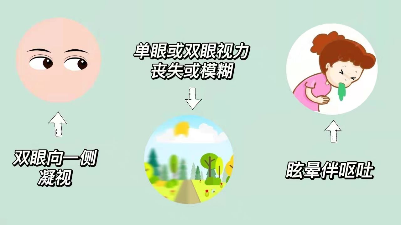 【图说科普】什么是脑梗