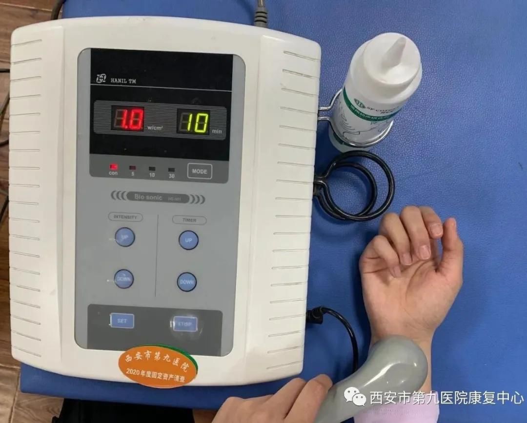 腕管综合征的康复治疗