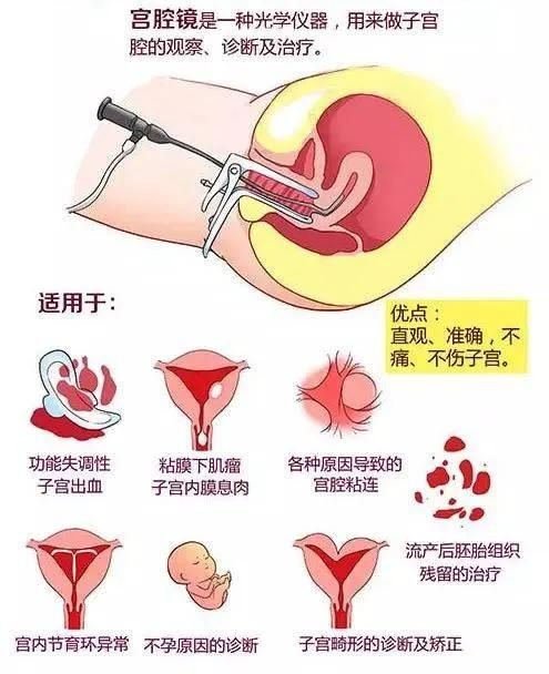 【科普园地】带你了解“神秘”的宫腔镜 【科普园地】带你了解“神秘”的宫腔镜