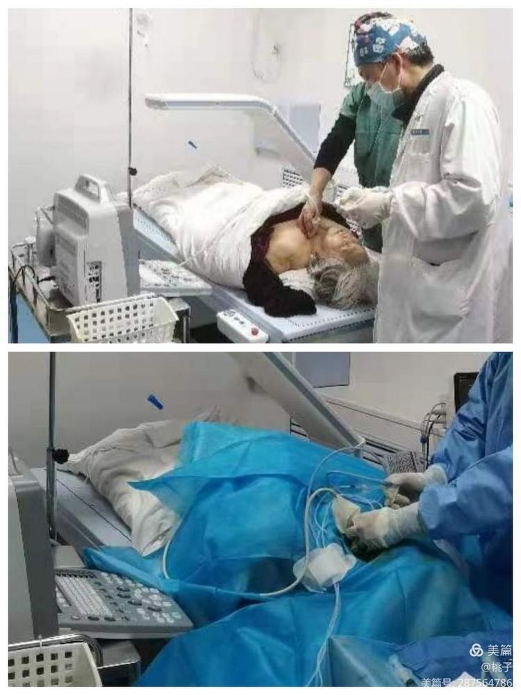 西安市第九医院胸外科甲状腺乳腺组为一名76岁聋哑女性行甲状腺微波消融术