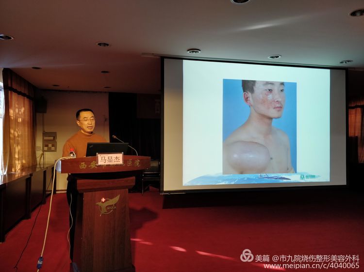 西安医学会烧伤外科分会暨陕西中西医结合学会烧伤分会2018年学术年会在西安市第九医院成功举行 西安医学会烧伤外科分会暨陕西中西医结合学会烧伤分会2018年学术年会在西安市第九医院成功举行