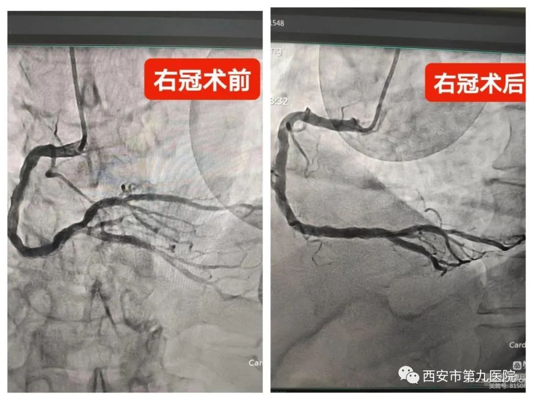 西安市第九医院120急救站与胸痛中心联合搭起“救心高速路” 西安市第九医院120急救站与胸痛中心联合搭起“救心高速路”