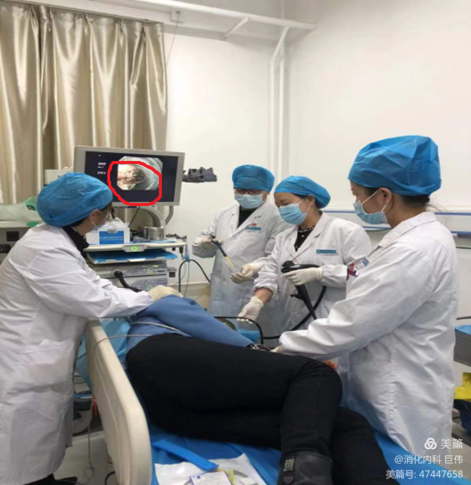 网篮在异物取出术中的应用