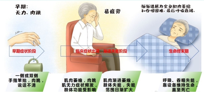 关注6.21世界渐冻人日 关注6.21世界渐冻人日