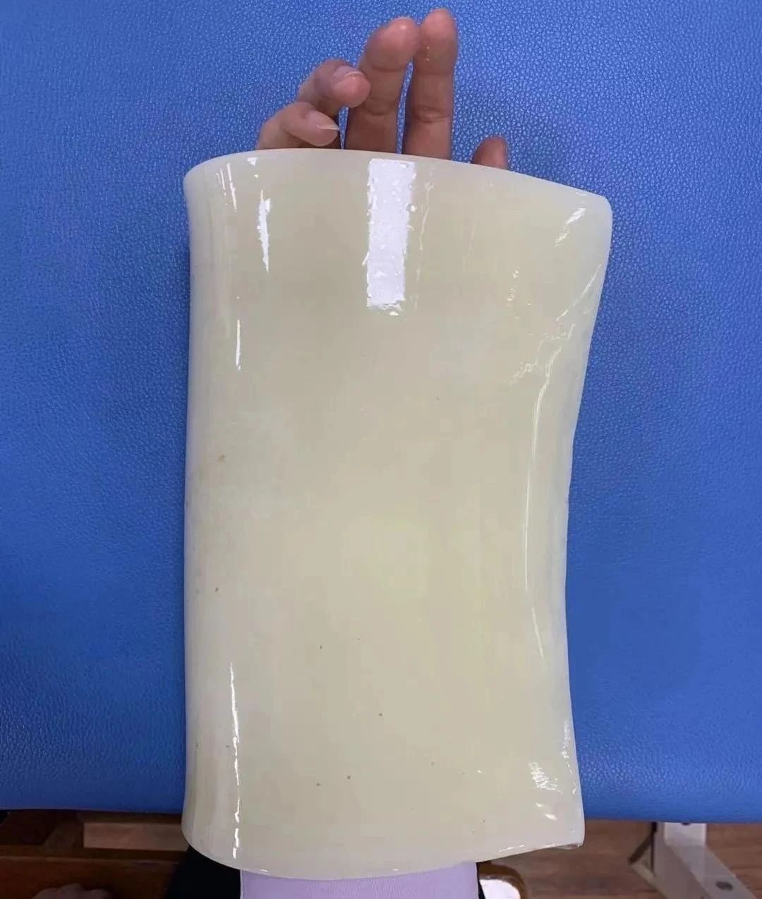 【健康科普】腕管综合征的康复治疗 【健康科普】腕管综合征的康复治疗