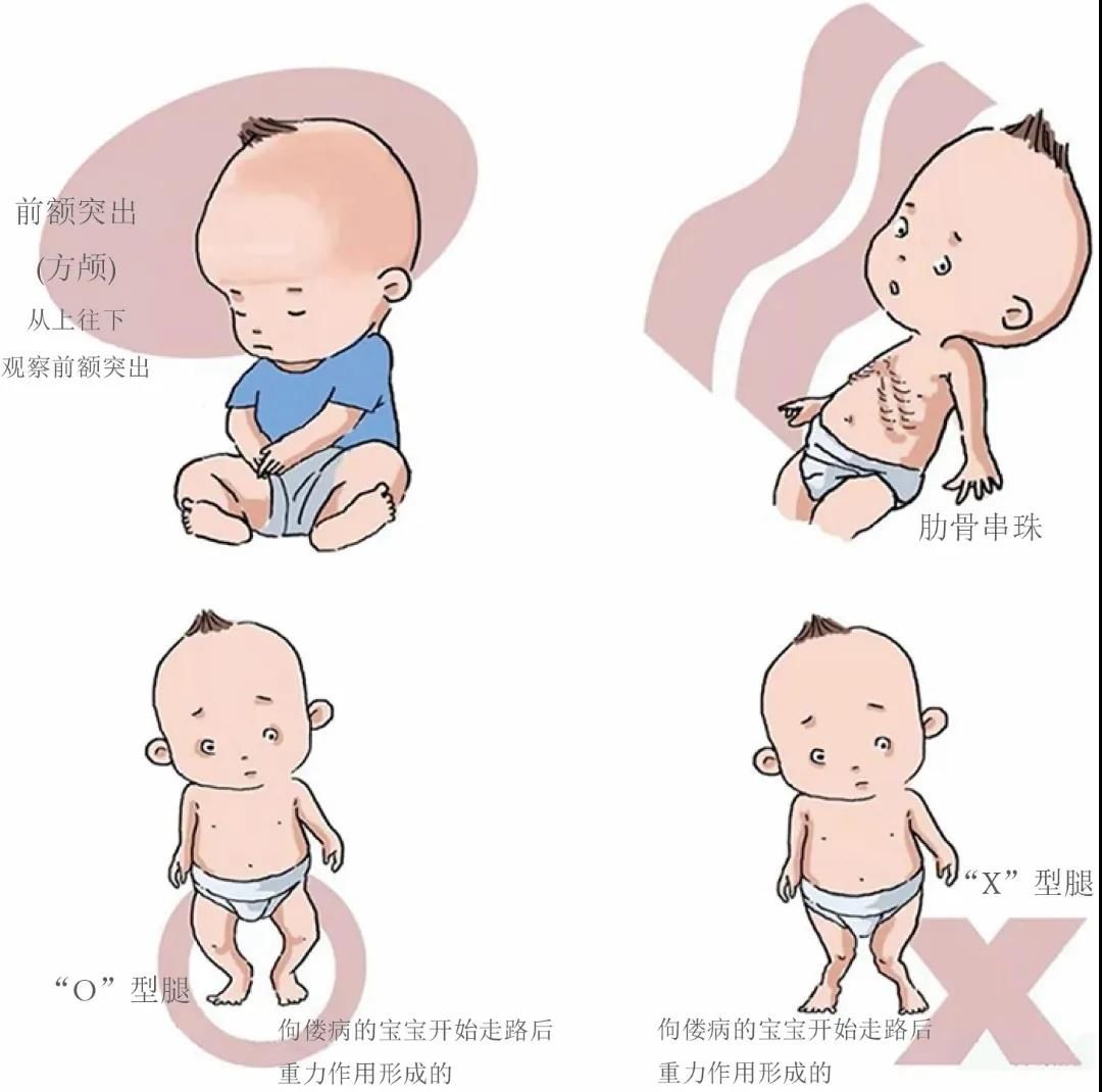 【专家笔谈】临床实践-补充维生素D那些事儿：一问一答