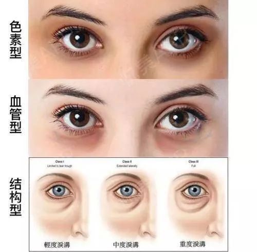 【科普公益】世界睡眠日——你,睡得好吗? 【科普公益】世界睡眠日——你,睡得好吗?