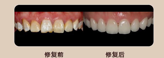 口腔科组织业务学习 提升专业技术服务广大病患 口腔科组织业务学习 提升专业技术服务广大病患