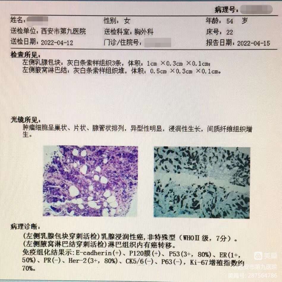 我院开展首例胸腔镜下内乳淋巴结清扫术 我院开展首例胸腔镜下内乳淋巴结清扫术