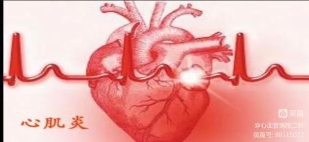 【健康科普】心肌炎患者应该注意什么? 【健康科普】心肌炎患者应该注意什么?