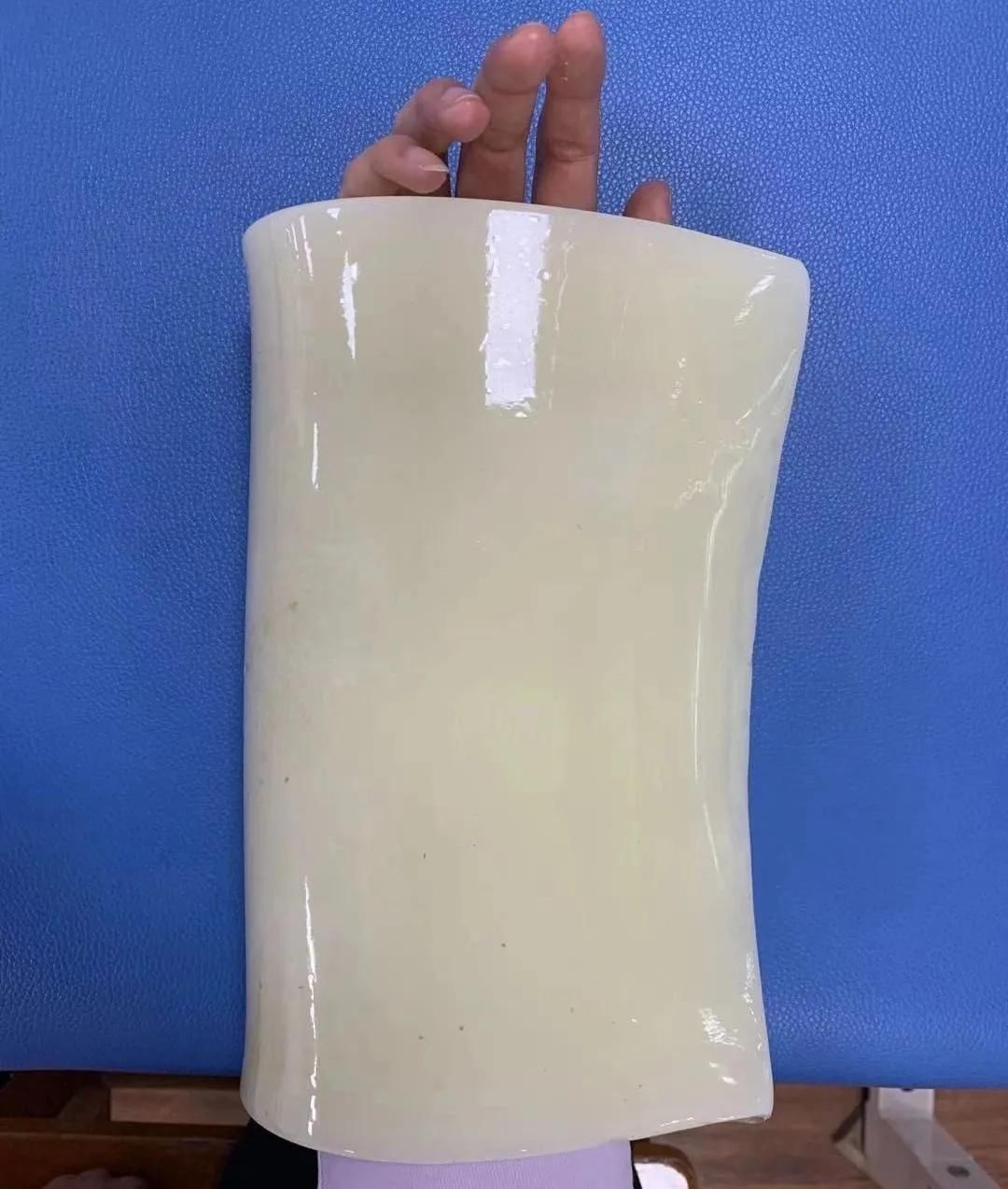 腕管综合征的康复治疗