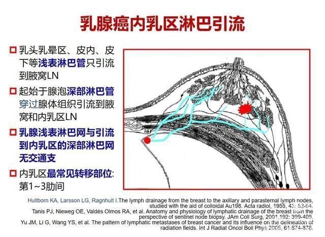 我院开展首例胸腔镜下内乳淋巴结清扫术 我院开展首例胸腔镜下内乳淋巴结清扫术