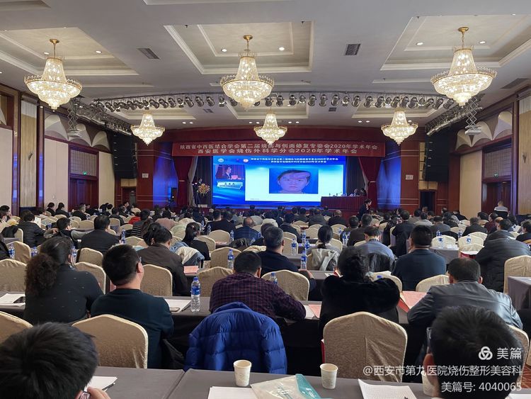【学术交流】“陕西省中西医结合学会烧伤与创面修复专委会”、“西安医学会烧伤外科学分会”2020年学术年会成功举办 【学术交流】“陕西省中西医结合学会烧伤与创面修复专委会”、“西安医学会烧伤外科学分会”2020年学术年会成功举办