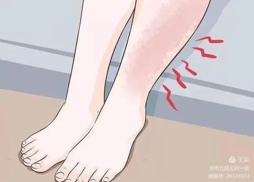 【健康科普】长途飞行会发生下肢深静脉血栓吗？