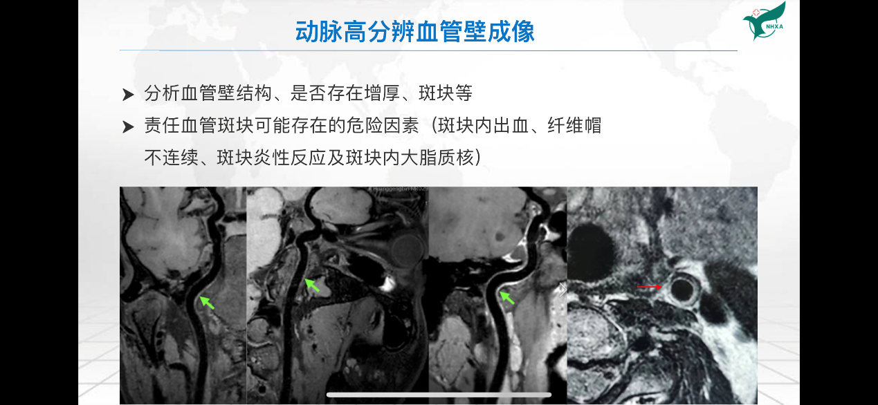 【医师风采】西安第九医院CT/MRI室主治医师王龙龙 【医师风采】西安第九医院CT/MRI室主治医师王龙龙