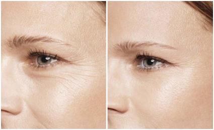 烧伤美容 烧伤美容