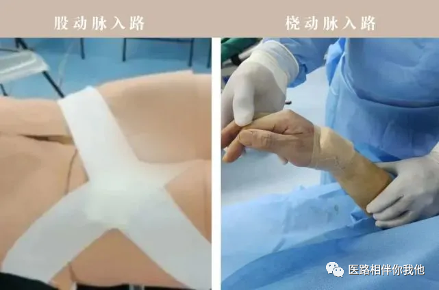 【健康科普】关注“头等”大事,关注大脑健康 【健康科普】关注“头等”大事,关注大脑健康