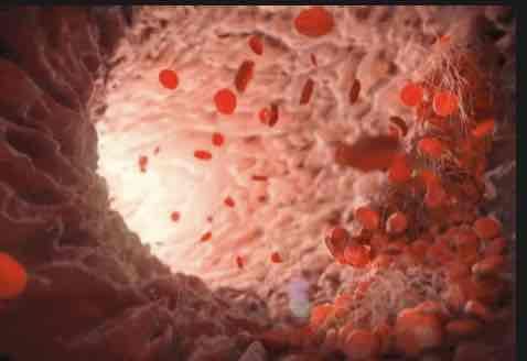 让我们一起揭开高血压真相！！！