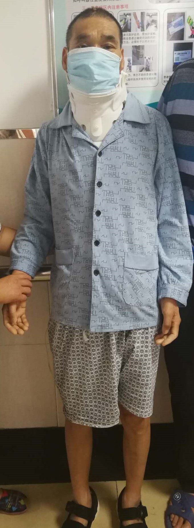 骨科救治一例颈髓损伤患者