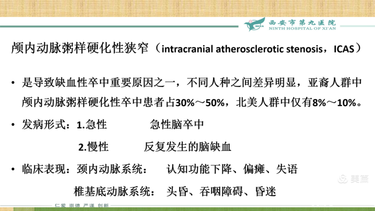 【特色技术】神经外科——球囊扩张及支架成形术治疗颅内动脉粥样硬化性狭窄（ICAS）