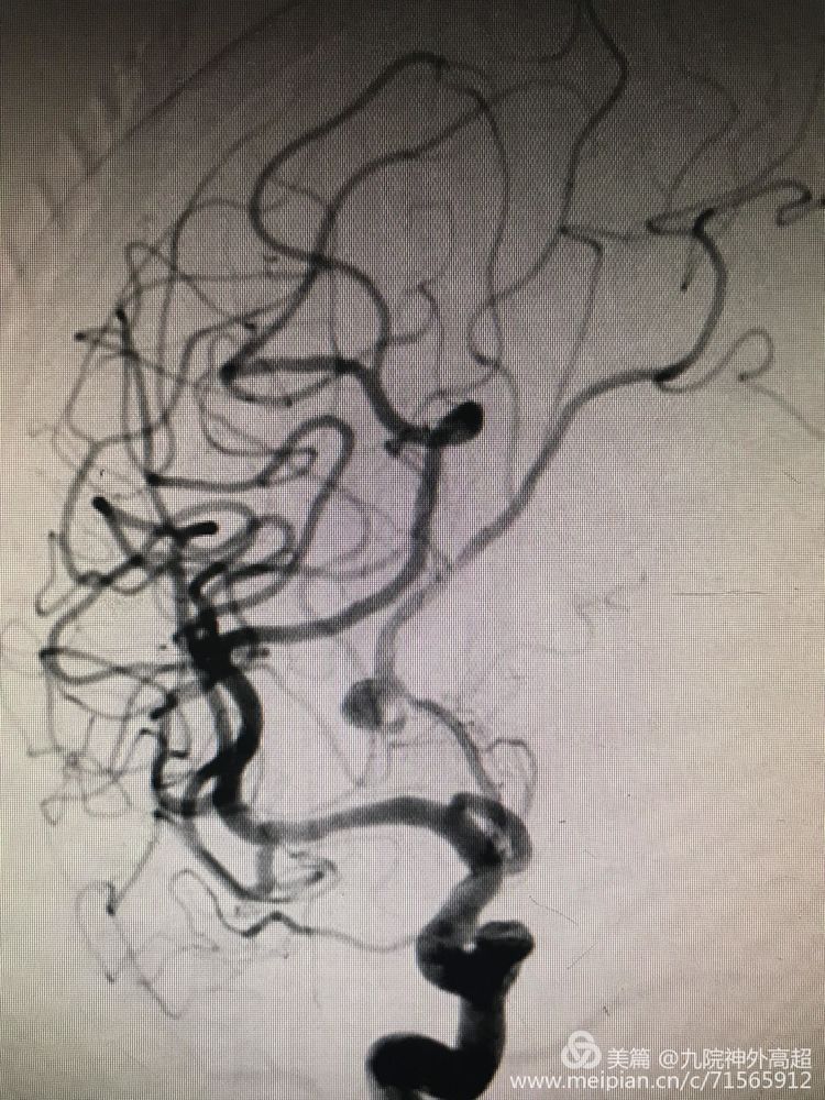 脑心同治 我们在路上 脑心同治 我们在路上