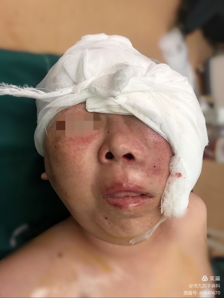 手术麻醉科“再战”困难气道